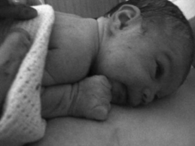 Jessica very soon after birth, in the delivery room